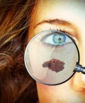 Cirugía y biopsia por cáncer de piel y tejidos blandos. Melanoma y sarcomas.
