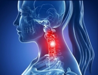 Especialista en dolor cervical o de cuello en Mérida. Atención, tratamiento o cirugía en caso de requerirse.