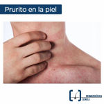 No permita que cualquier alteración en la piel, como el caso de la dermatitis quede sin atención por parte de un dermatólogo. El dr. Cervera le tiene la solución. Experiencia a su servicio.