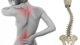 La escoliosis es una desviación lateral de la columna vertebral que se puede corregir por el especialista en columna.