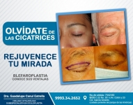 Especialista en cirugía para la reparación de párpados caídos y rejuvenecer tu mirada. Procedimiento seguro que no deja cicatrices.